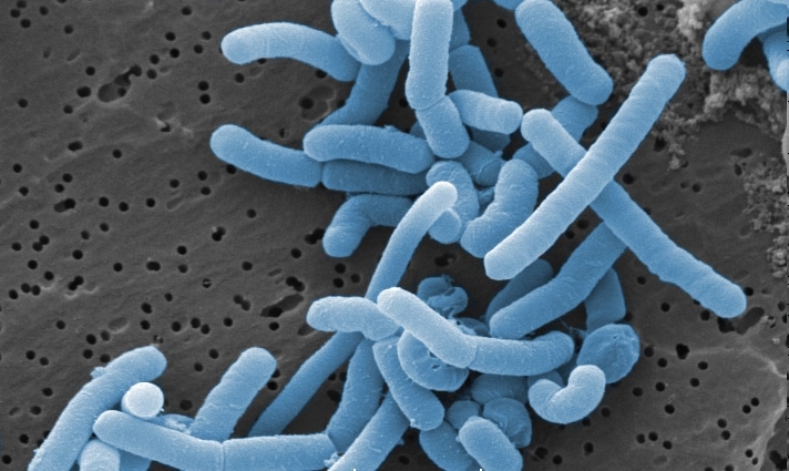 Endometrial microbiome bacteria visualization